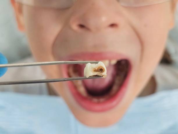 Emergency Dentist for Kids in MI